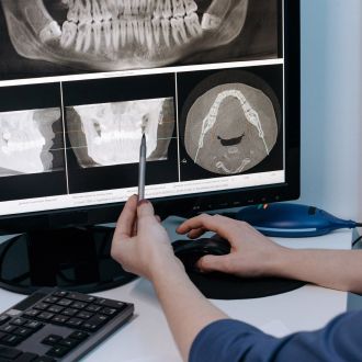 Abbildung: Wir arbeiten mit modernster digitaler Technologien, wie zum Beispiel dem 3D Intraoralscanner - Ihr Zahnarzt in Weiden